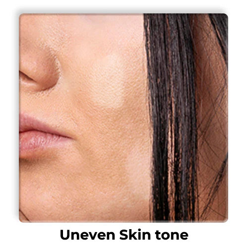 Uneven-Skin-tone-1 (1)